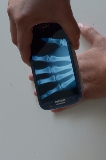 x光相机手机版 v3.0 安卓版0