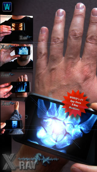 手机透视看手骨苹果软件 v2.9 iPhone版0