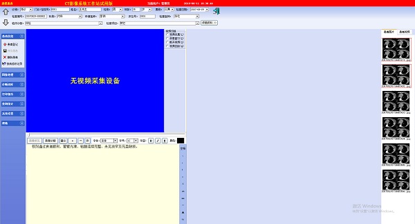 ct影像系统工作站 v7.1 安装版1