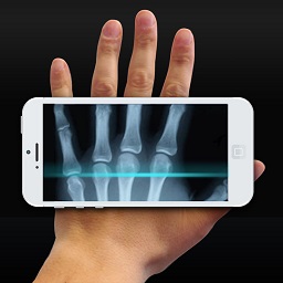 手机偷袭x计划(xray scan)