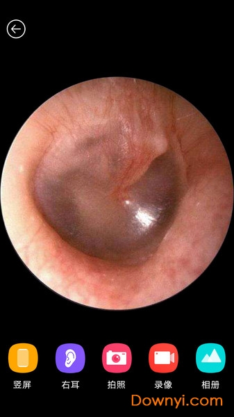 小米bebird(蜂鸟采耳) v6.0.34 安卓版1