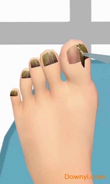 我爱修脚游戏 v1.0 安卓版0