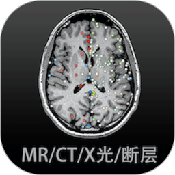 医学影像解剖图谱