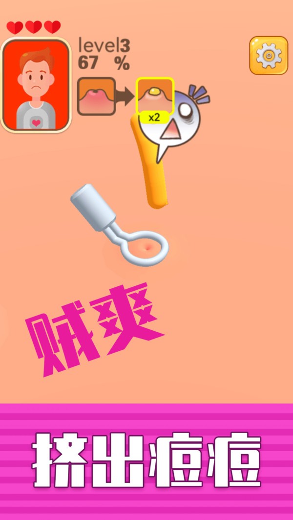 挤痘贼爽小游戏 v1.0.0 安卓版2